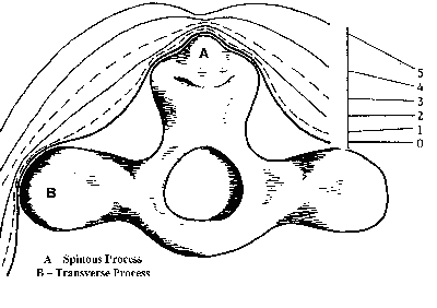 Figure 2 is a diagram of the lumabar vertebra-anterior view indicating profile lines for each body condition score.