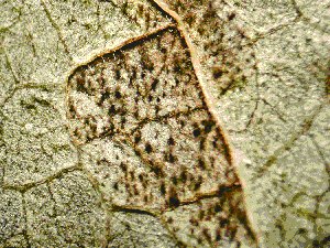 Shows tuffs of stalks bearing spores protruding from Angular leaf spot lesions on underside of infected snap bean leaflet.